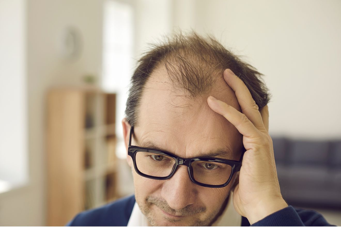 The Definitive Guide to Hair Loss in Men and Thinning Hair in Men